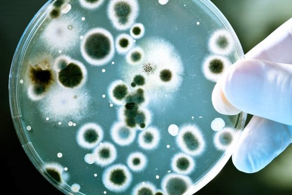 Bacteria Test Ireland